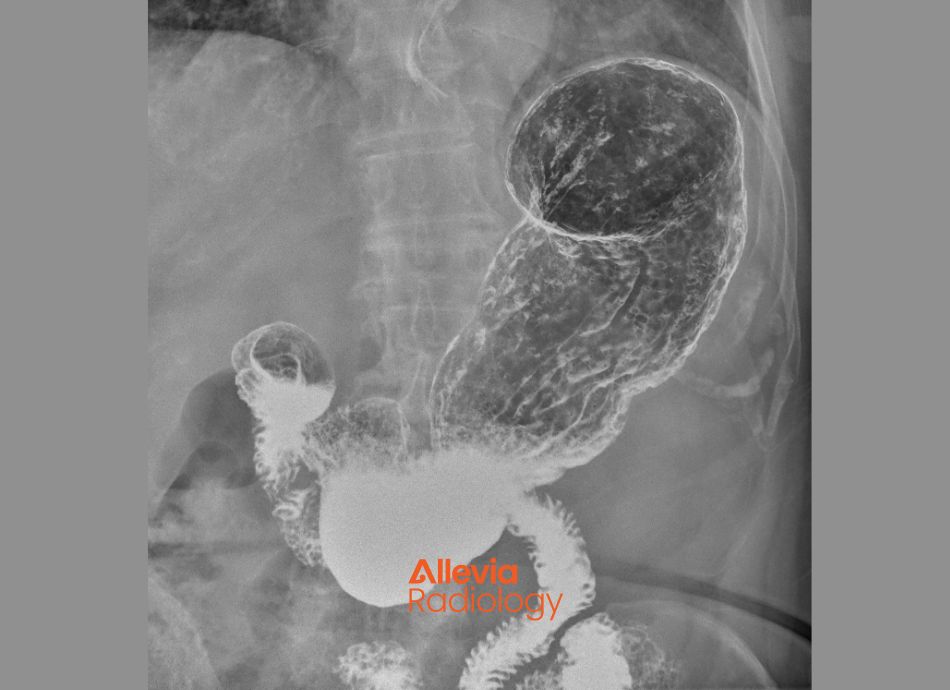 Allevia Radiology fluoroscopy