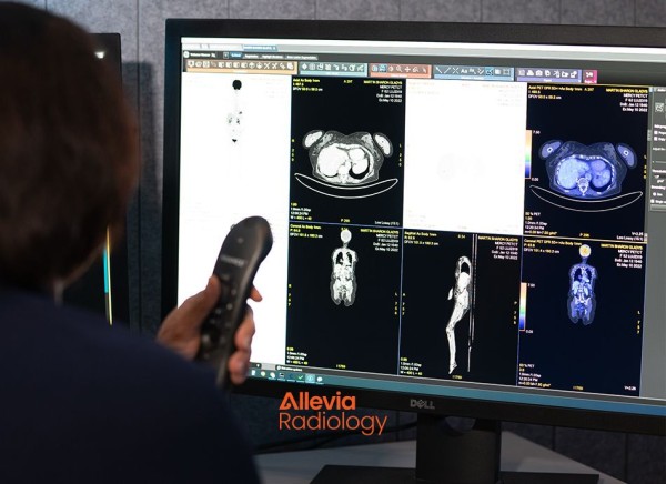 Checking scan imaging on screen at Allevia Radiology