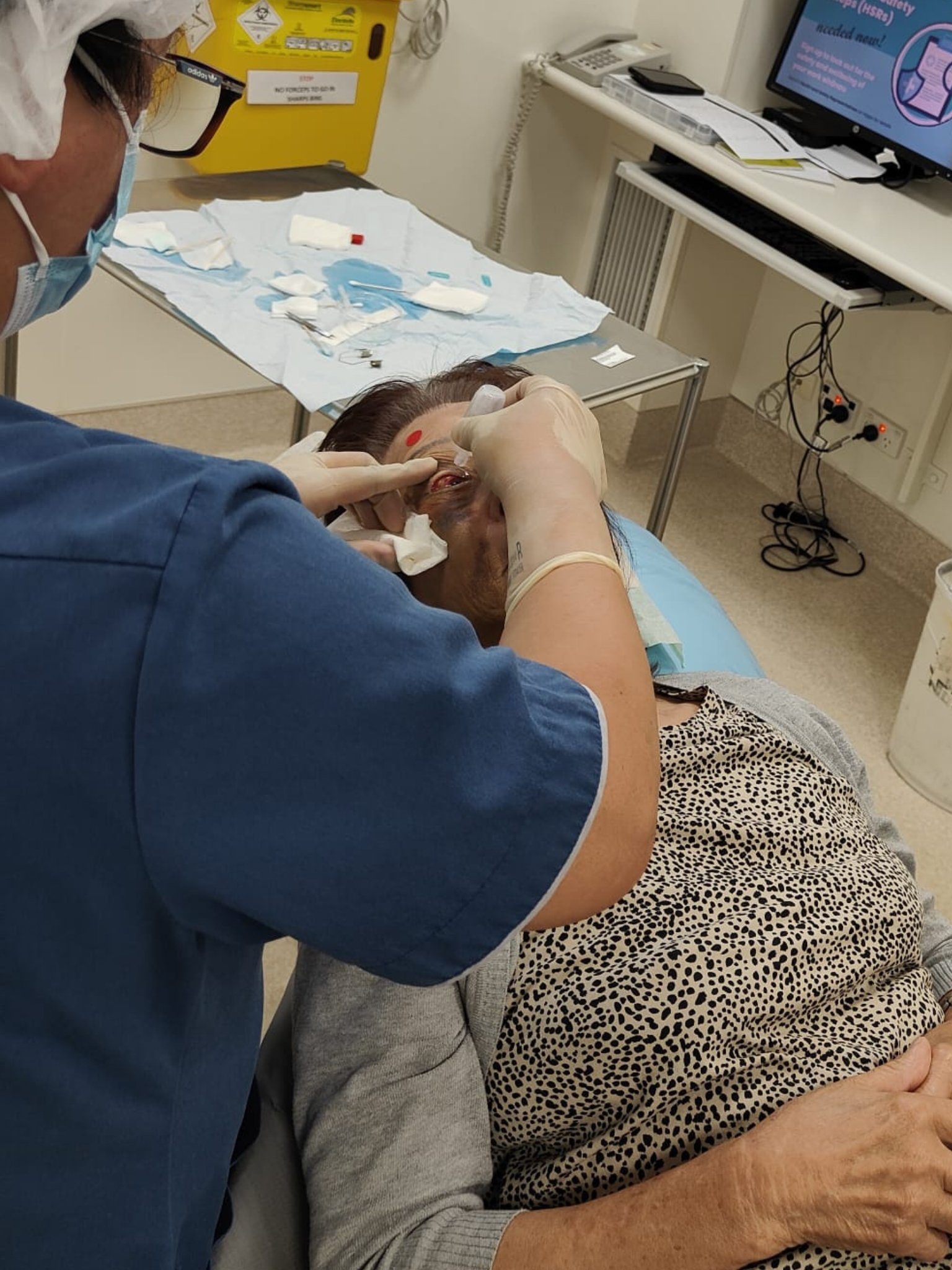 Instilling eye drops