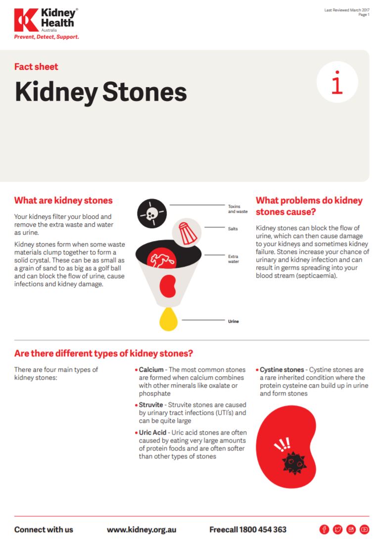kidney stones fact sheet