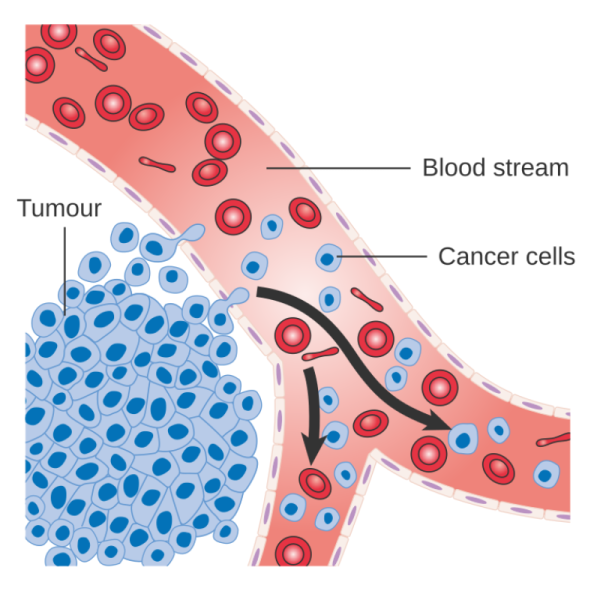 How cancer cells metastasise