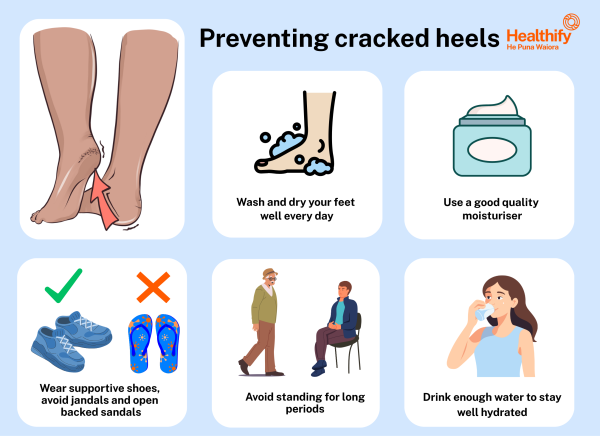 Ways to avoid getting cracked heels