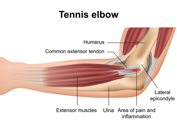 Labelled image of elbow and muscles and tendons
